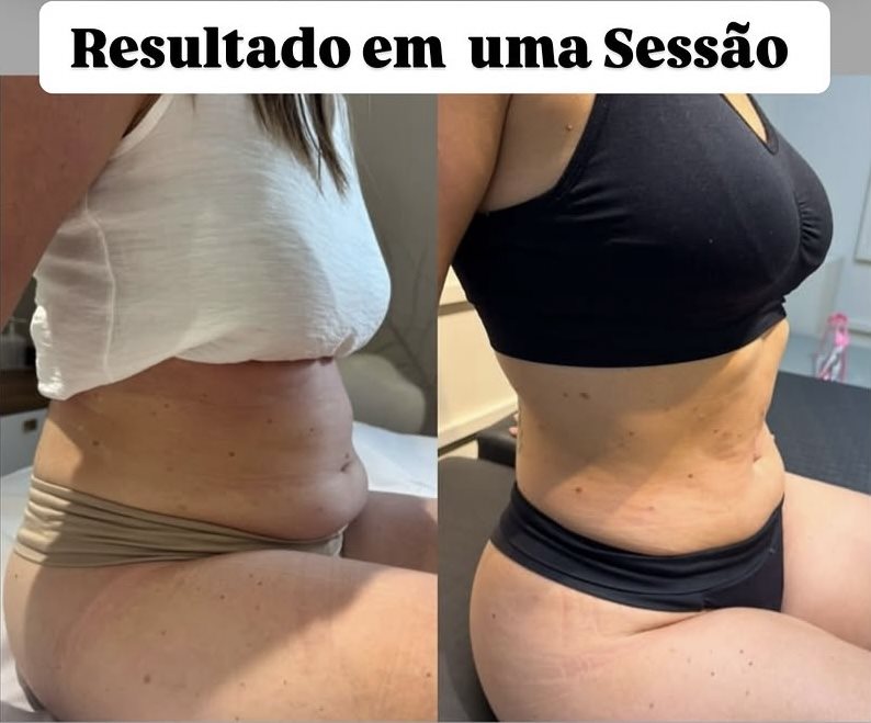 Resultado após uma sessão